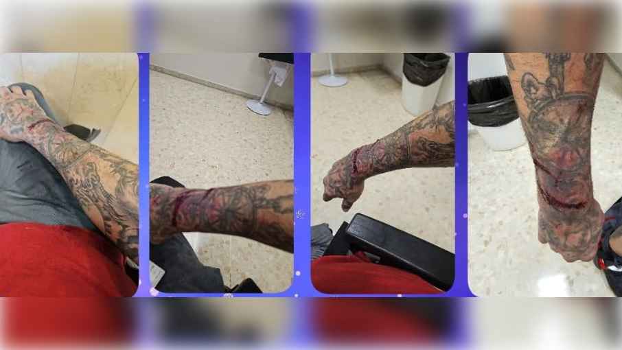 Heridas sufridas por el trabajador del servicio de grúas. 