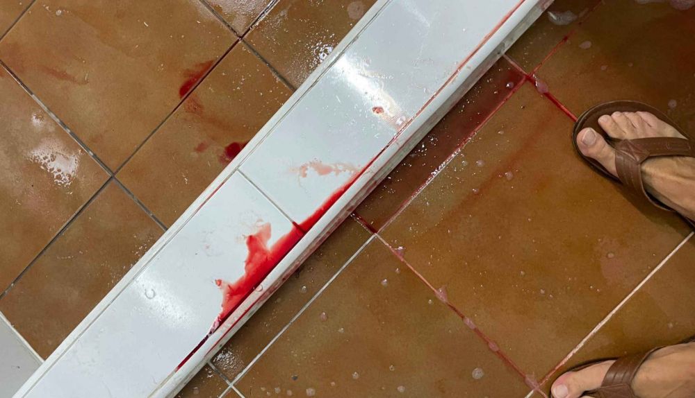 Sangre del pequeño Hugo tras el grave accidente.