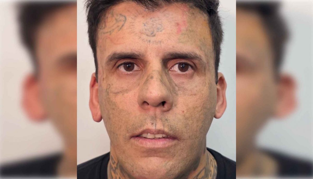 Así ha quedado el rostro de Leandro.