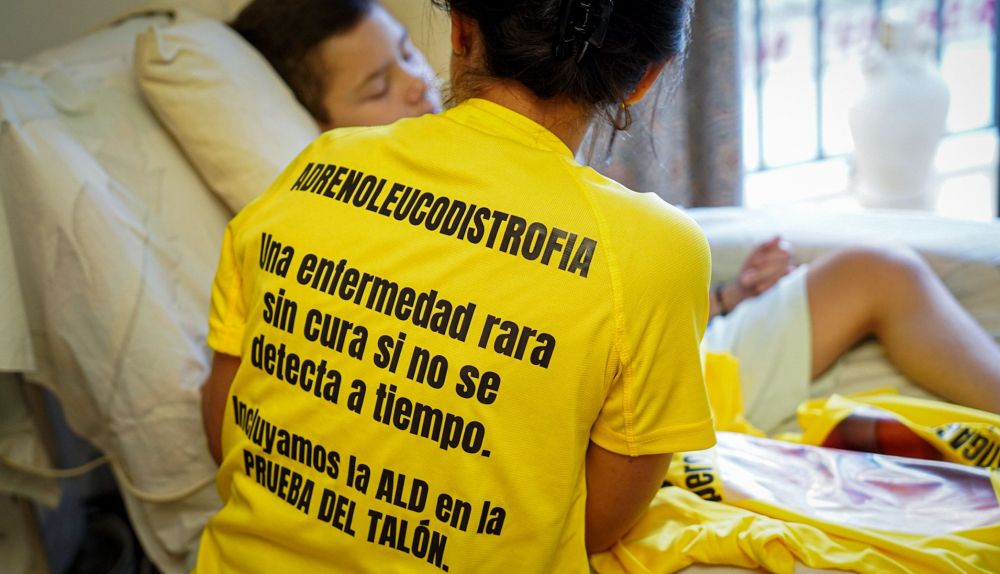 Juan adrenoleucodistrofia 03