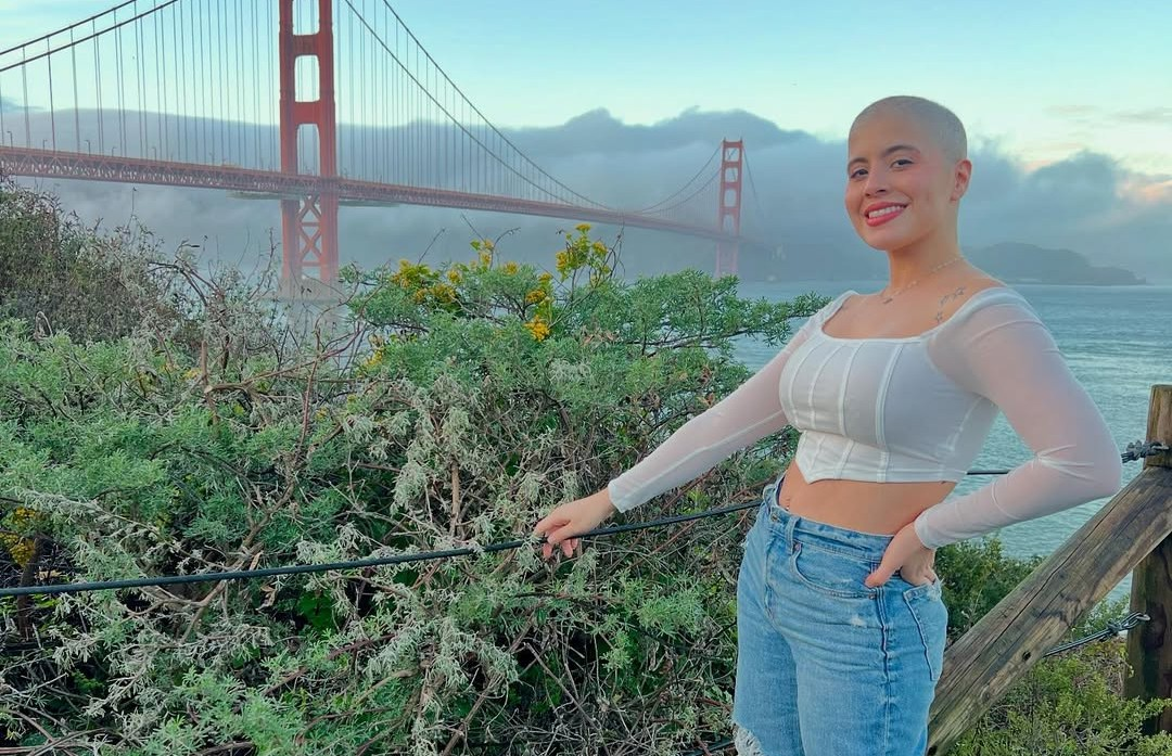 Paola Caldera, influencer que ha documentado su leucemia.