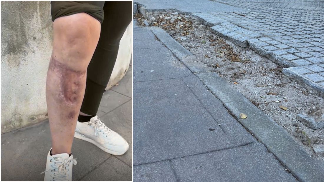 Heridas provocadas por la caída por los escalones en mal estado en El Puerto.