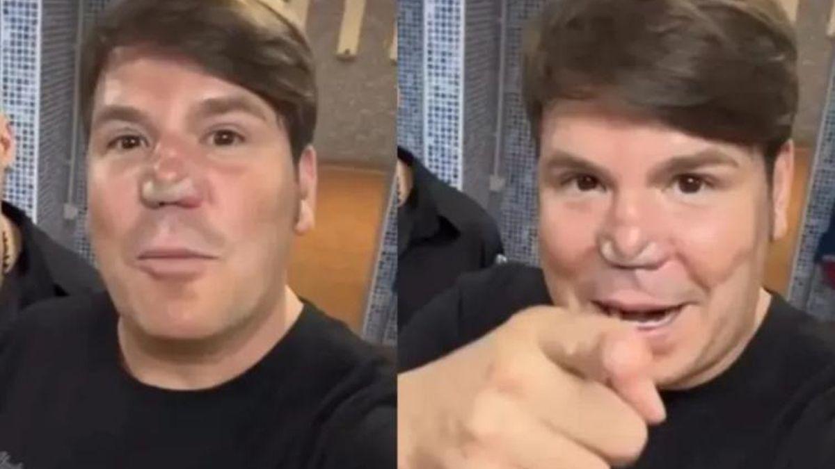 Lucas muestra la tira nasal adhesiva de su nariz.