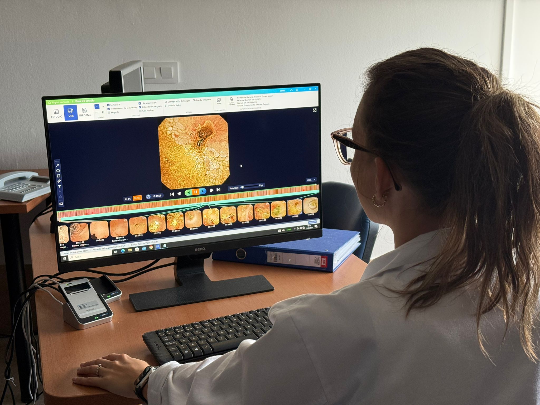 Cápsula endoscópica en funcionamiento en el Hospital de Puerto Real. Cápsula endoscópica en funcionamiento en el Hospital de Puerto Real.