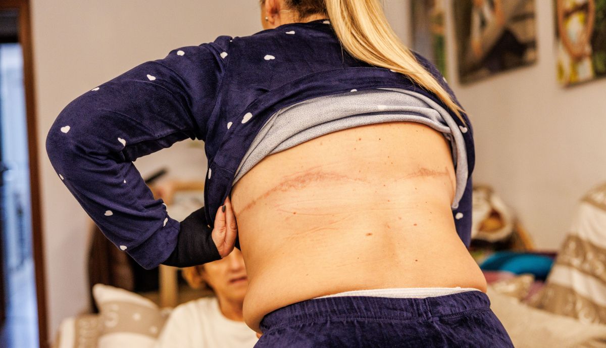 Llesica incapacidad absoluta  01