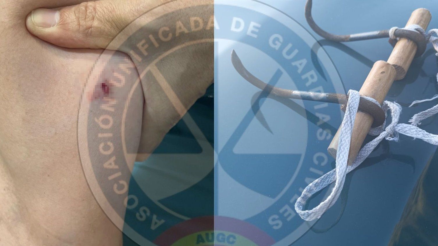 El garfio utilizado para herir a un guardia civil en Ceuta. El garfio utilizado para herir a un guardia civil en Ceuta.