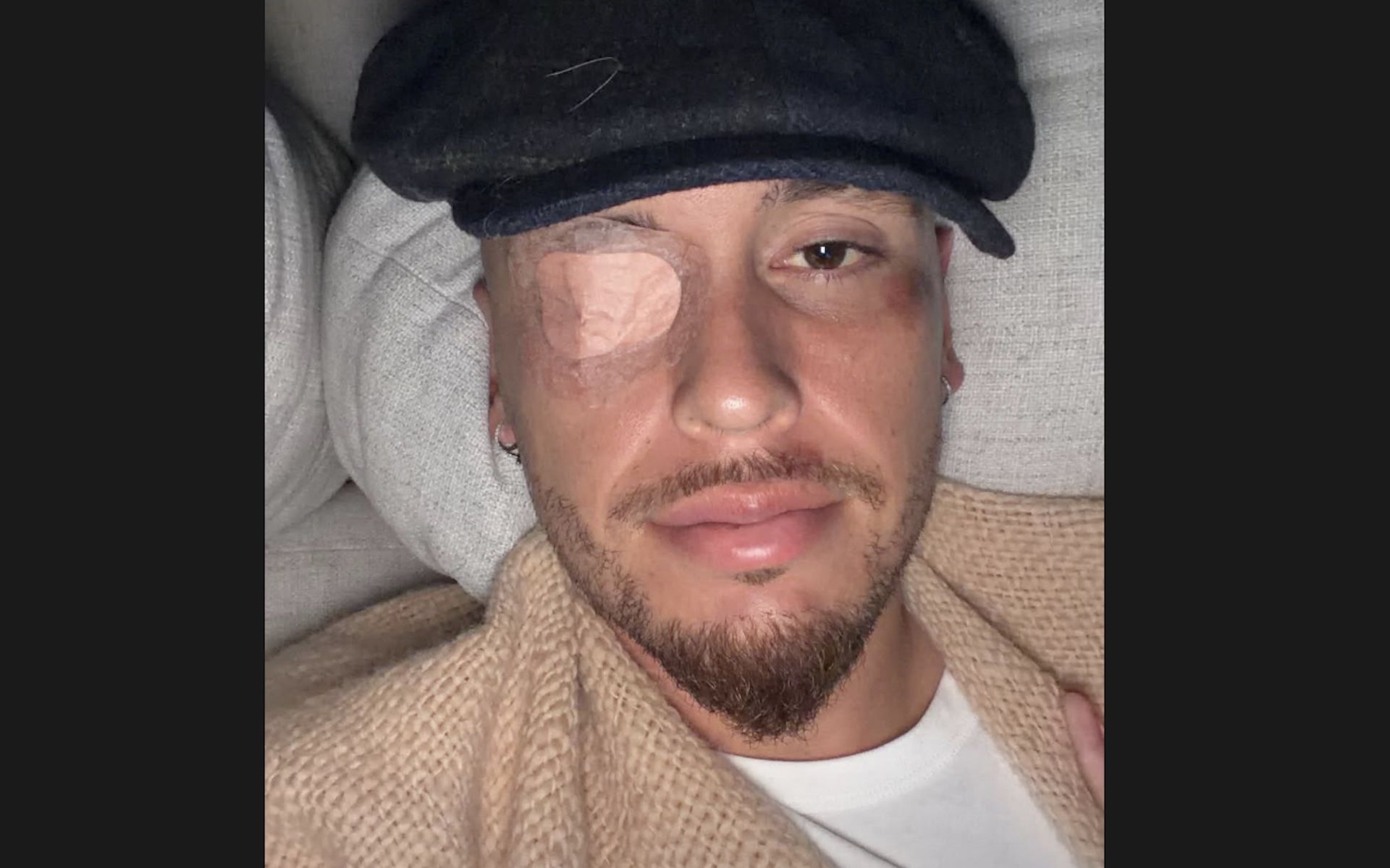 Lucas Ocampos, exjugador del Sevilla, sufre una parálisis facial. Lucas Ocampos, exjugador del Sevilla, sufre una parálisis facial.