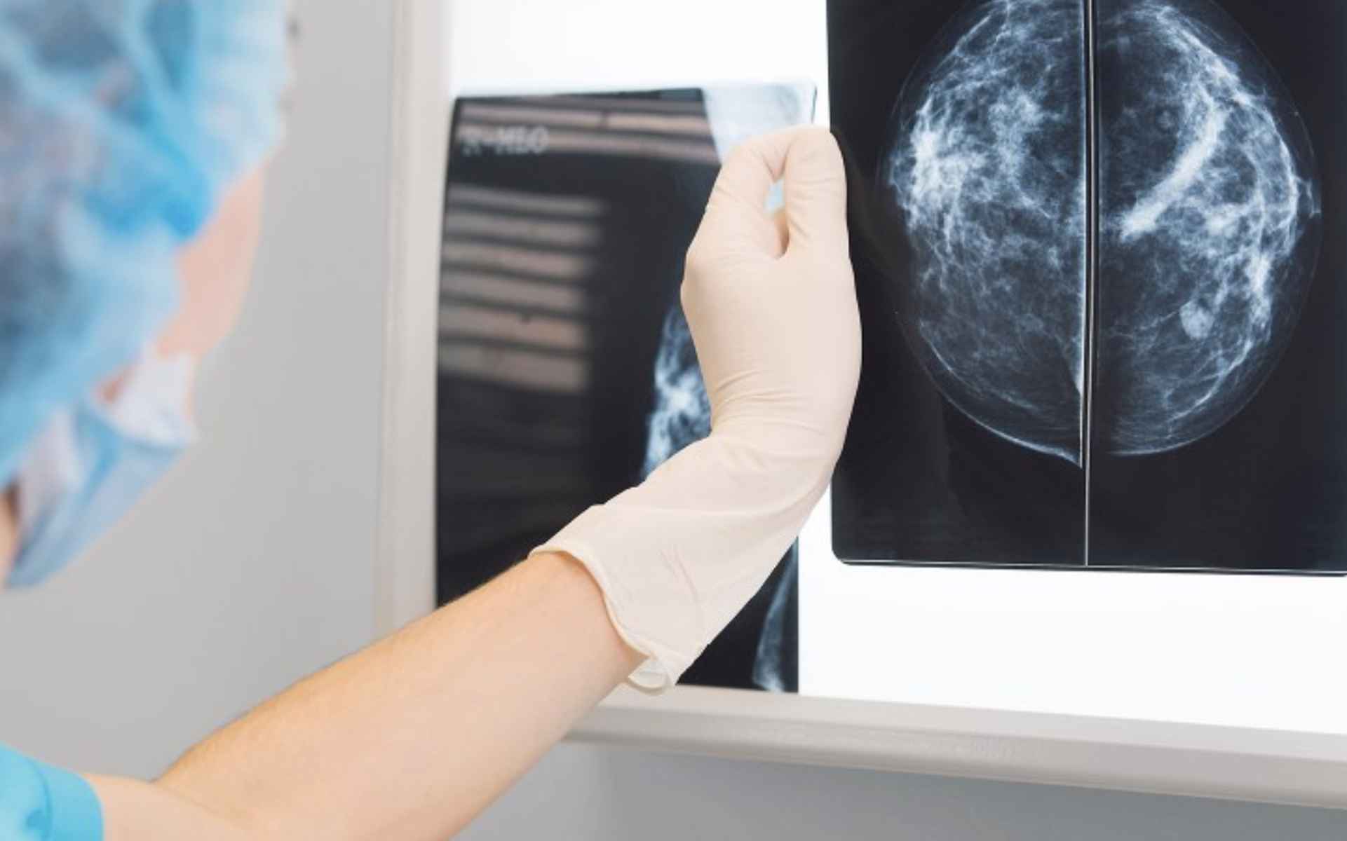 Una doctora analizando unas pruebas.