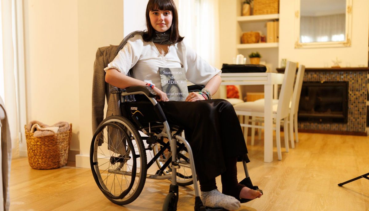 Carlota sindrome de Sudeck  4