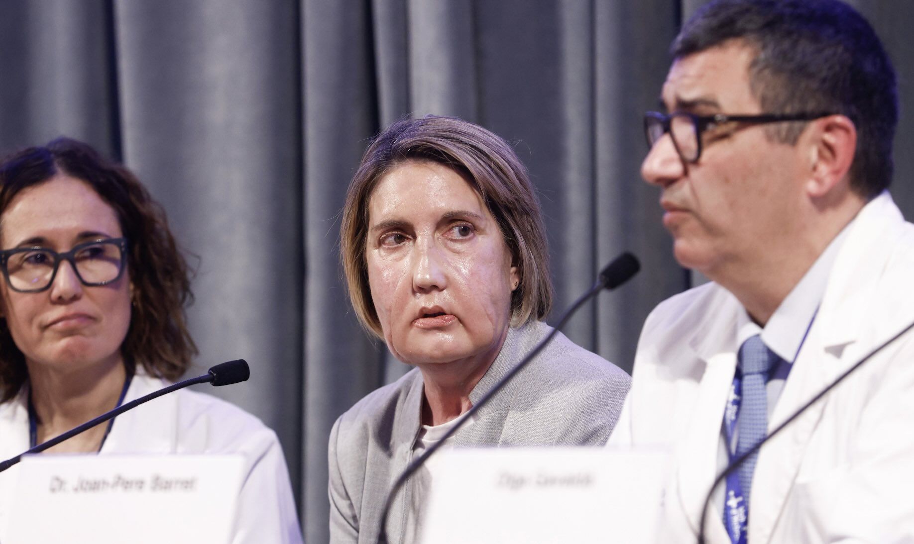 Carme, transplantada de cara, en el centro, con profesionales del Hospital Universitario Vall d'Hebron.