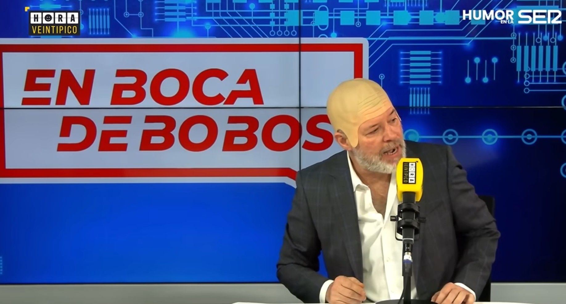 Quequé, en su imitación de Nacho Abad.