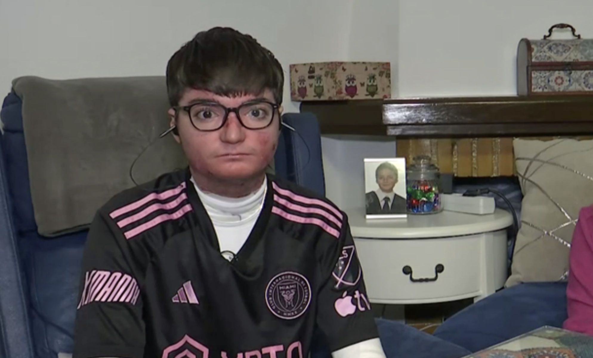 Adrián, el malagueño que recibirá la medicación para la Piel de Mariposa. Foto: Canal Sur