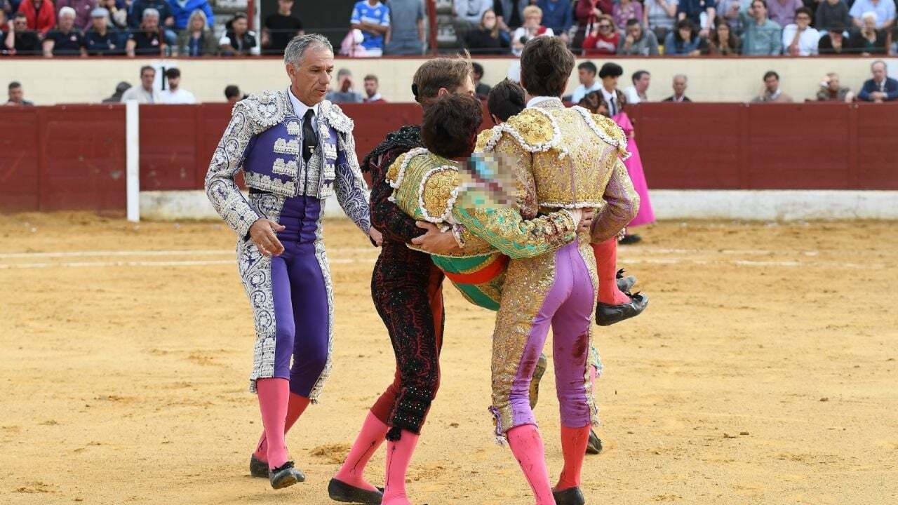 El torero Alberto Durán, tras la cogida en Valdemoro.