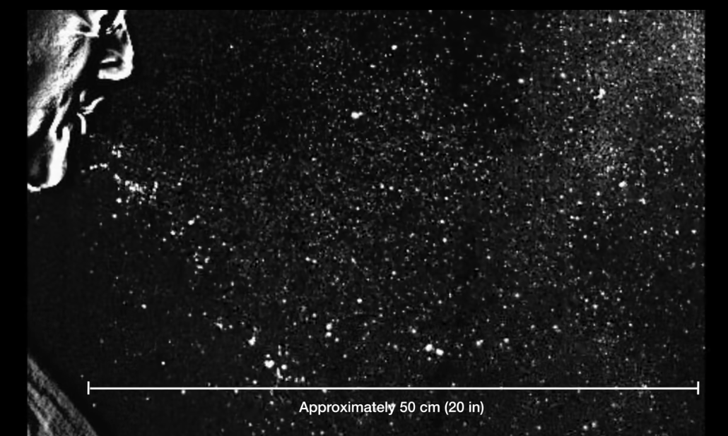 Aerosoles, en una imagen extraída de un vídeo de Journal of the American Medical Association.