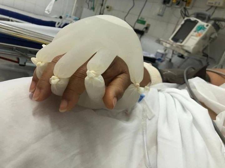 La 'mano de Dios' ideada por una enfermera brasileña.
