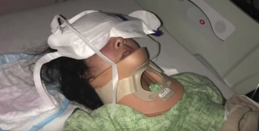 Anna Worden, en el hospital tras sufrir el accidente.