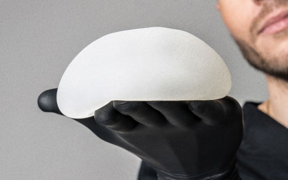 Cada Cuanto Se Cambian Los Implantes De Pecho Tribunales | Fallece una gaditana por un agresivo cƔncer provocado