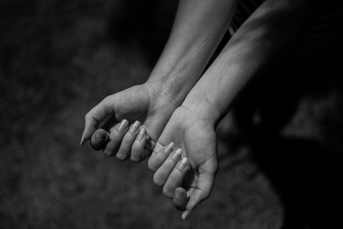 'Uve' enseña las cicatrices de sus brazos. La joven intentó suicidarse en dos ocasiones.