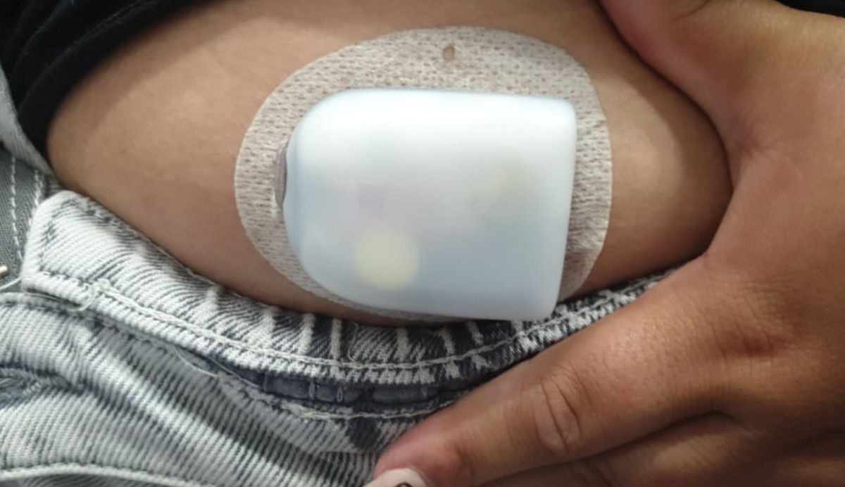 Robo de una bomba de insulina en Jerez.