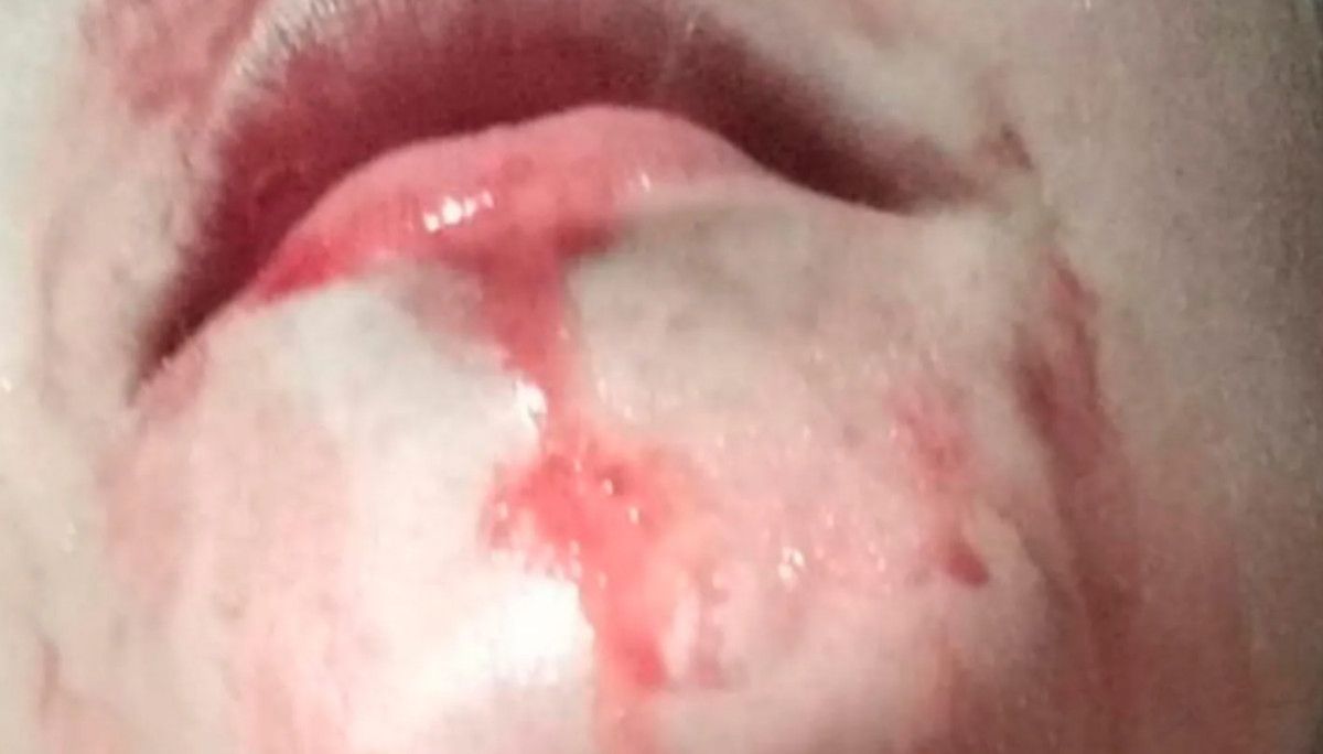 Un joven transexual sufre una terrible agresión en La Línea.