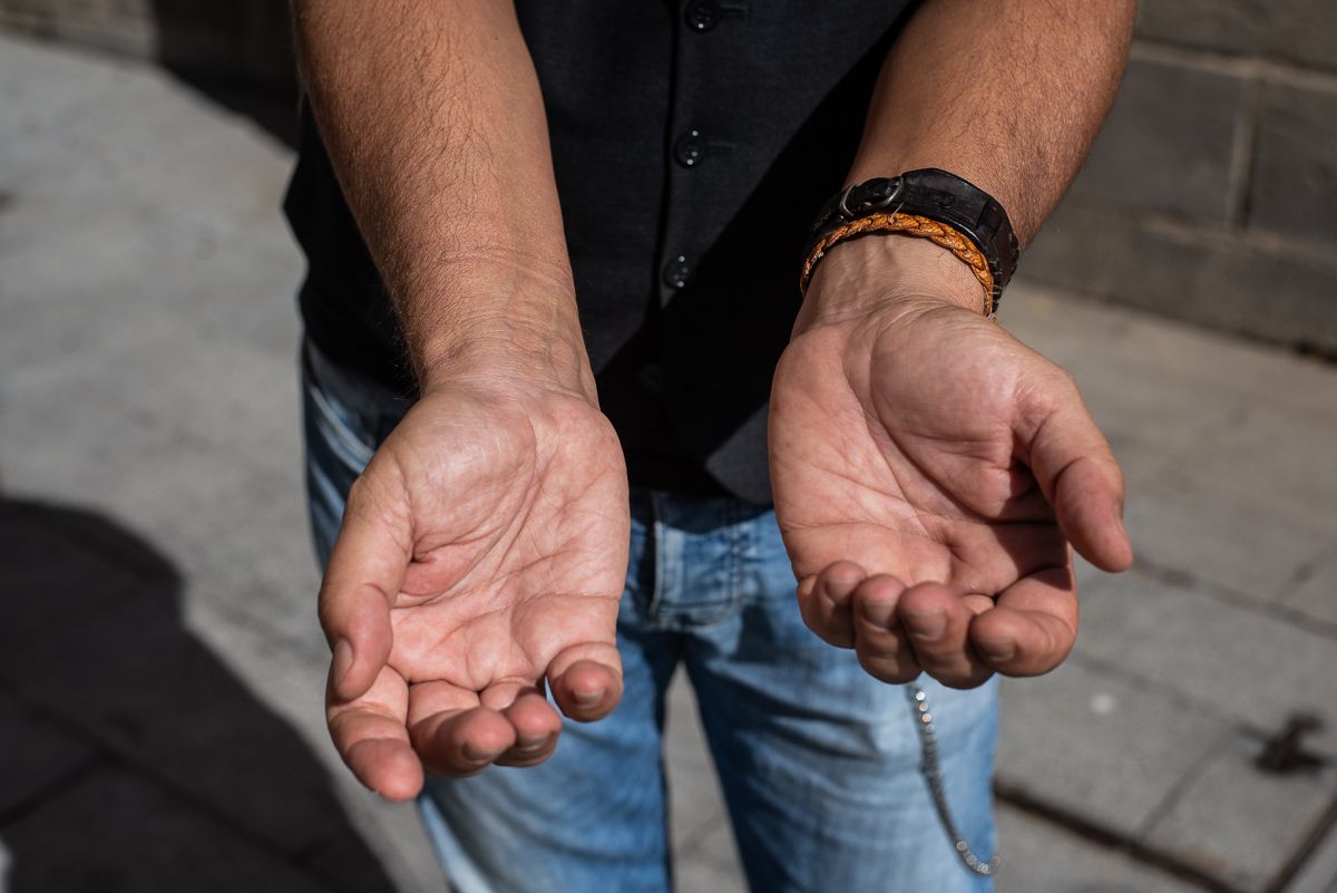 ANTONIO CONDUCTOR DE AMBULANCIA LESION MANO 3