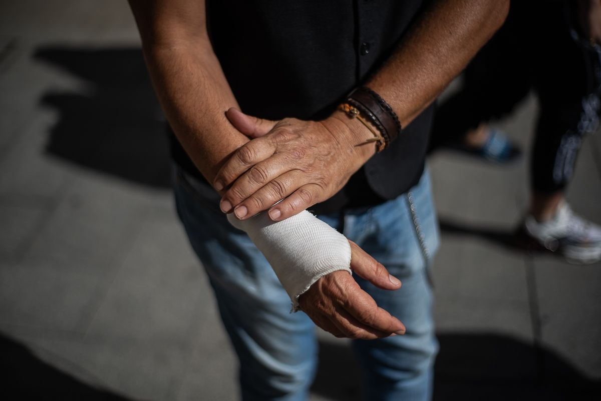 Antonio Moreno, técnico de transporte sanitario, con la mano derecha vendada.