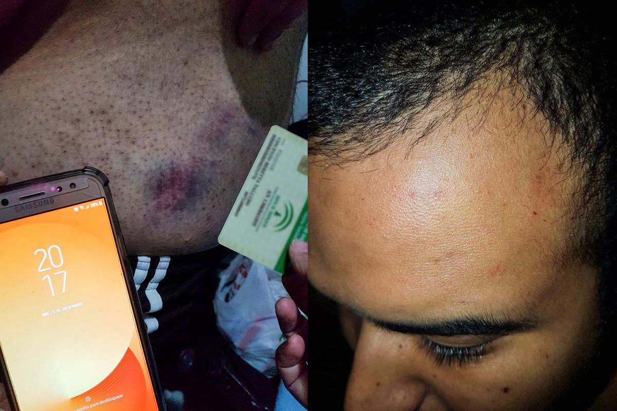 Las heridas de VIcenzo, uno de los detenidos en Cádiz