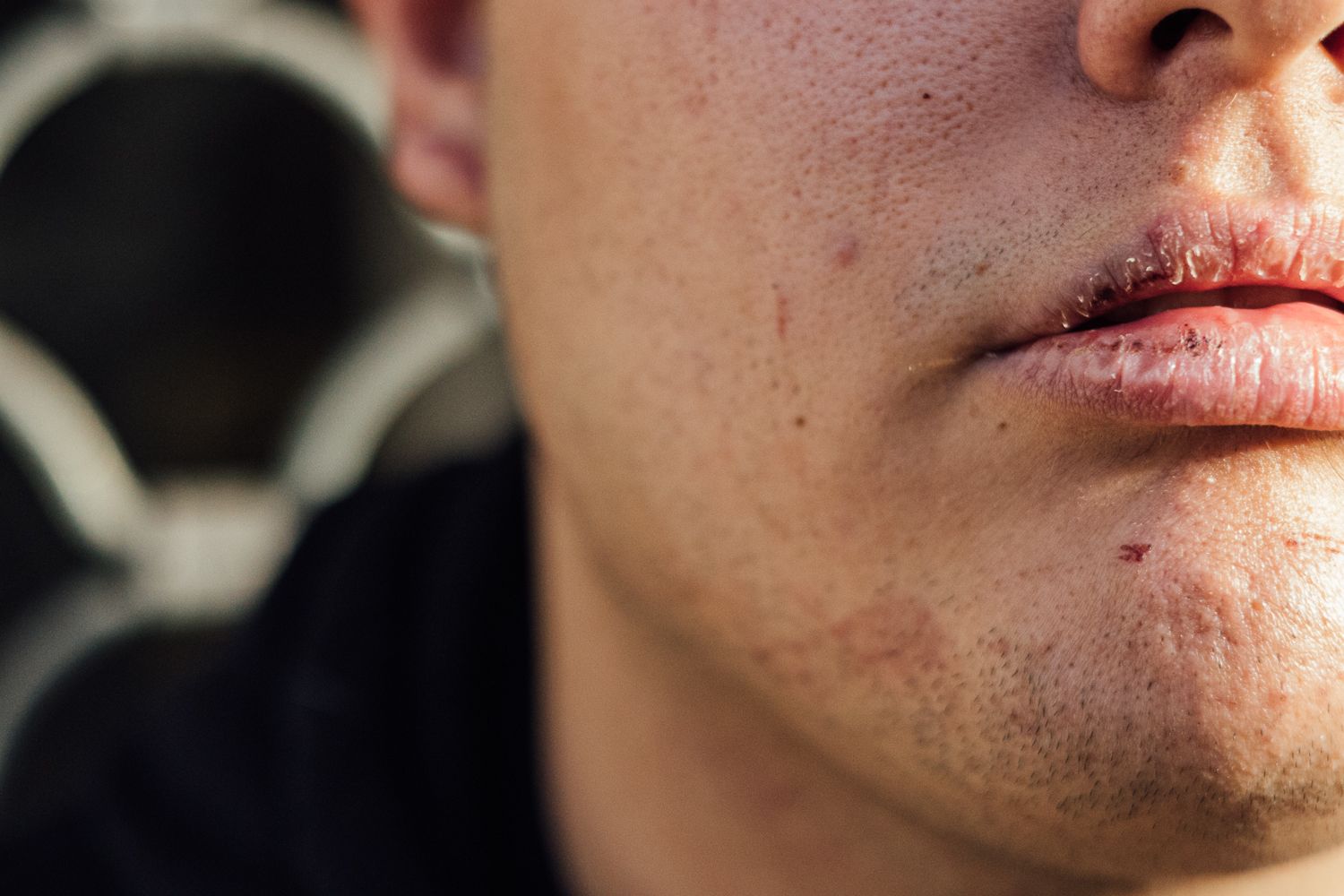 Rostro de Emi, el joven agredido en Jerez, tras la paliza.