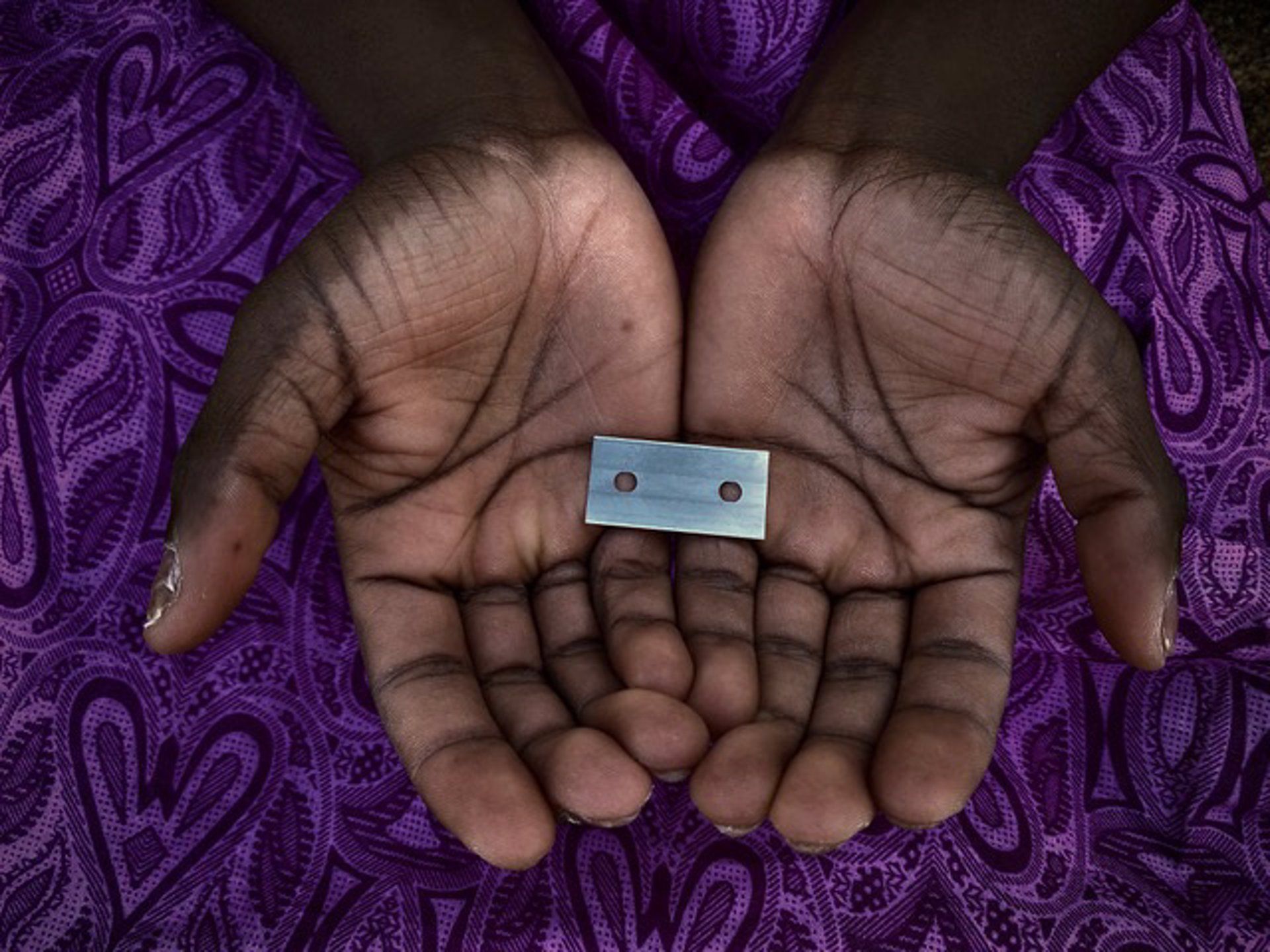 Mutilación genital femenina.   FUNDACIÓN DR. IVAN MAÑERO
