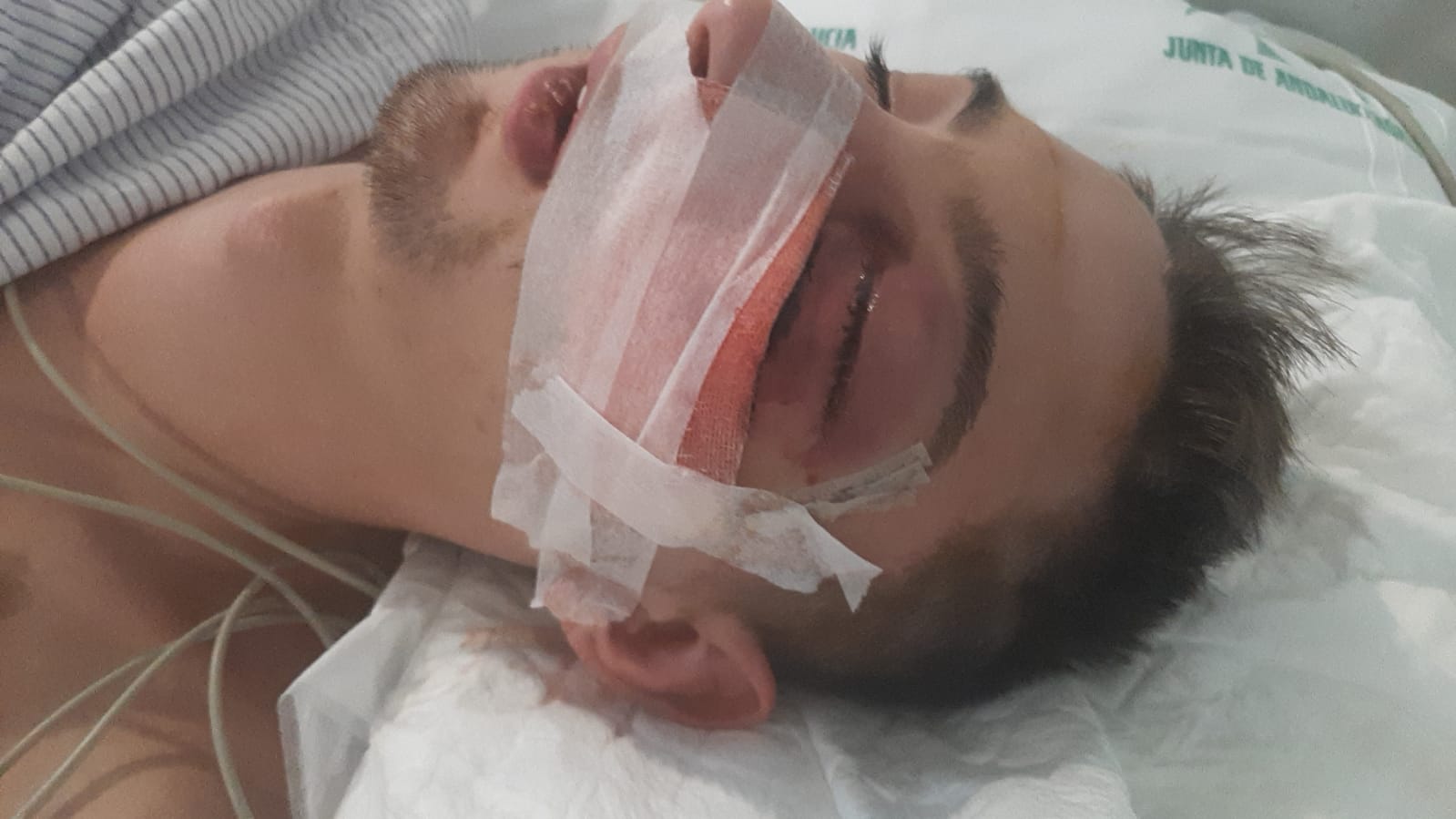 Andrés Jesús, víctima de una paliza grupal en Estancia Barrera, ingresado tras ser operado de urgencia en el Puerta del Mar de Cádiz, en una foto cedida por su familia a lavozdelsur.es