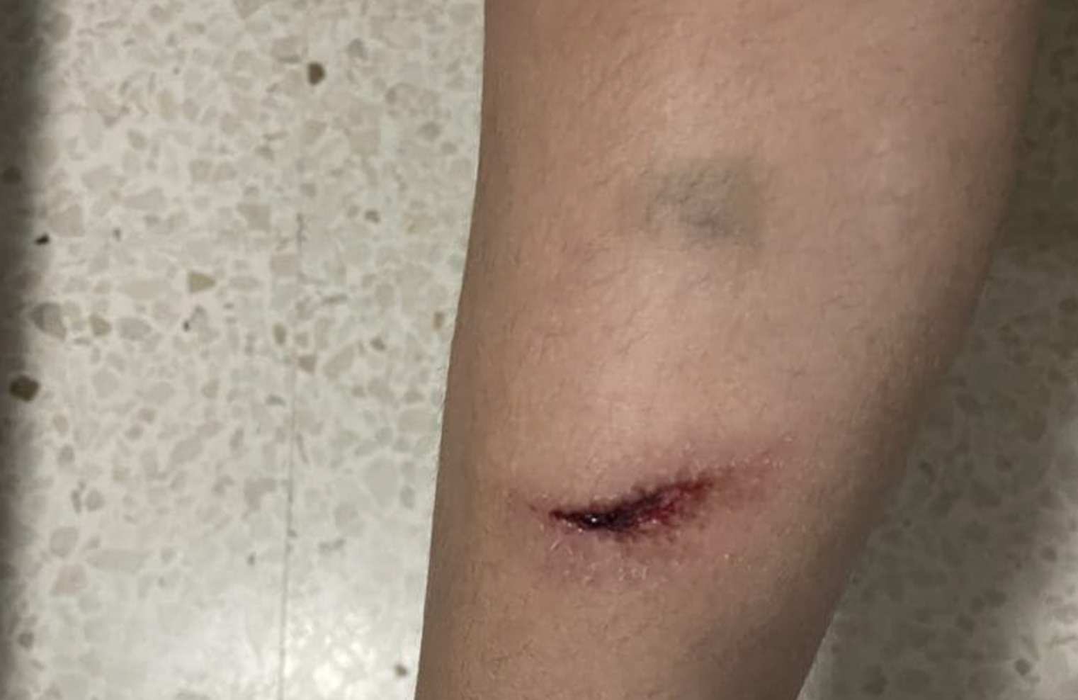 Niña herida tras meter el pie en una alcantarilla en la calle Pozo Amarguillo de Sanlúcar.